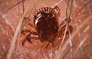 Pest Control for Ticks